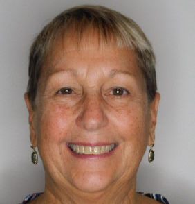 Jennifer Fischer, PA